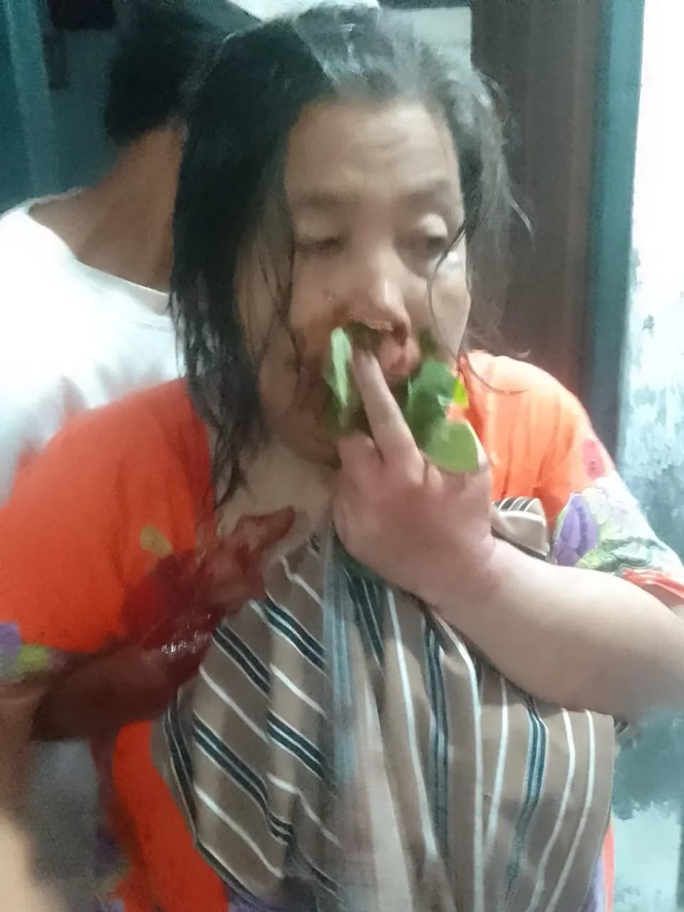 donasi-saat-ini, ibu hamida membutuhkan bantuan untuk per