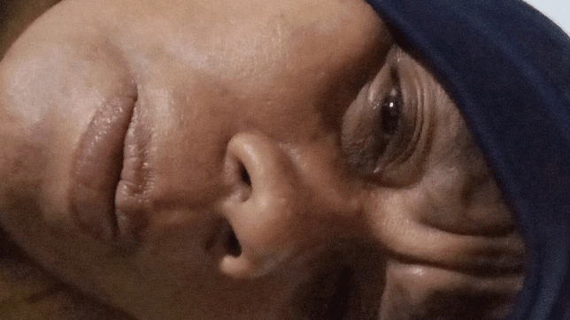 donasi-saya-didiagnosis mengidap tumor ganas di rektum. s