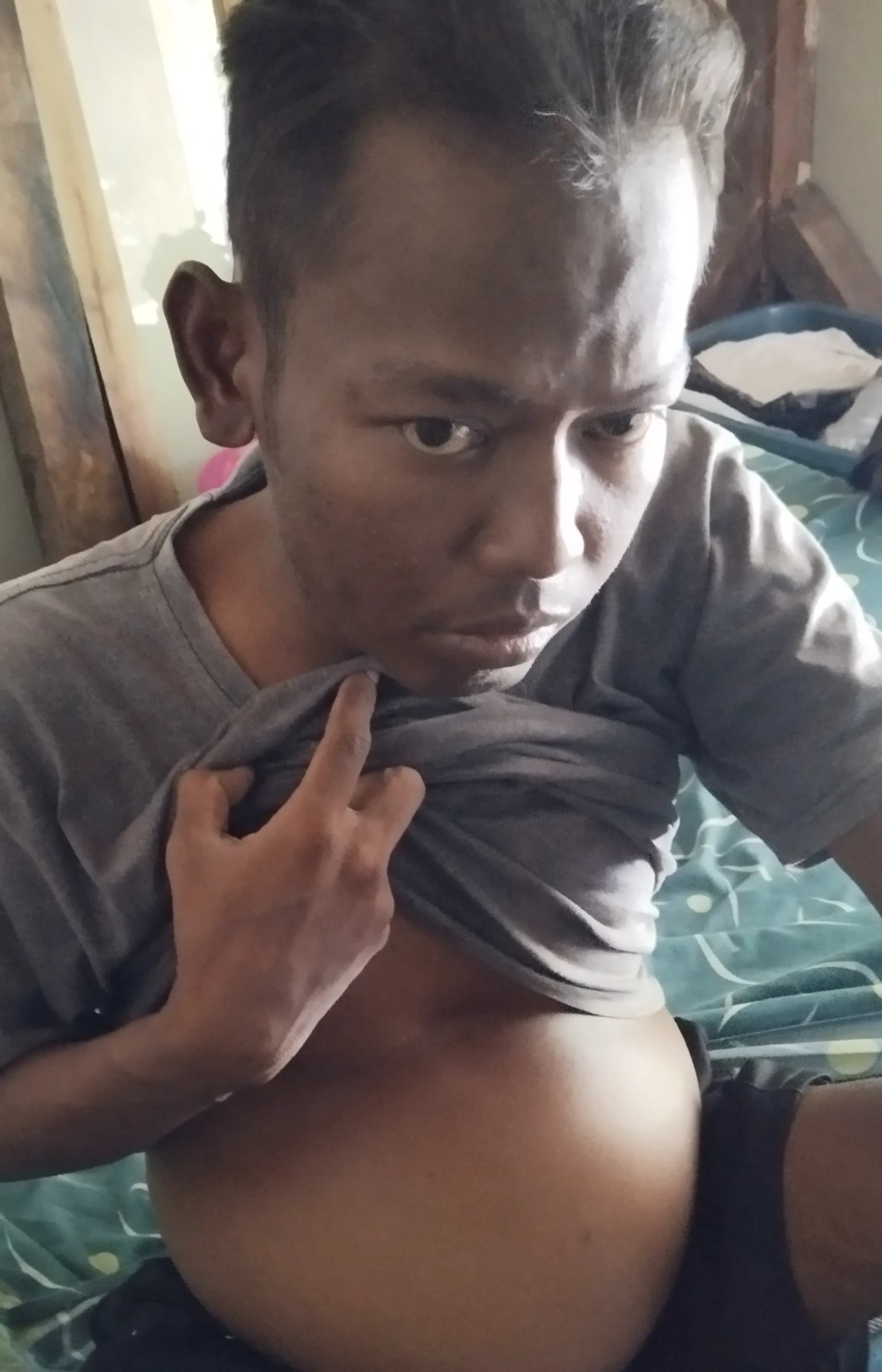 donasi-saya-membutuhkan bantuan anda untuk menjalani oper