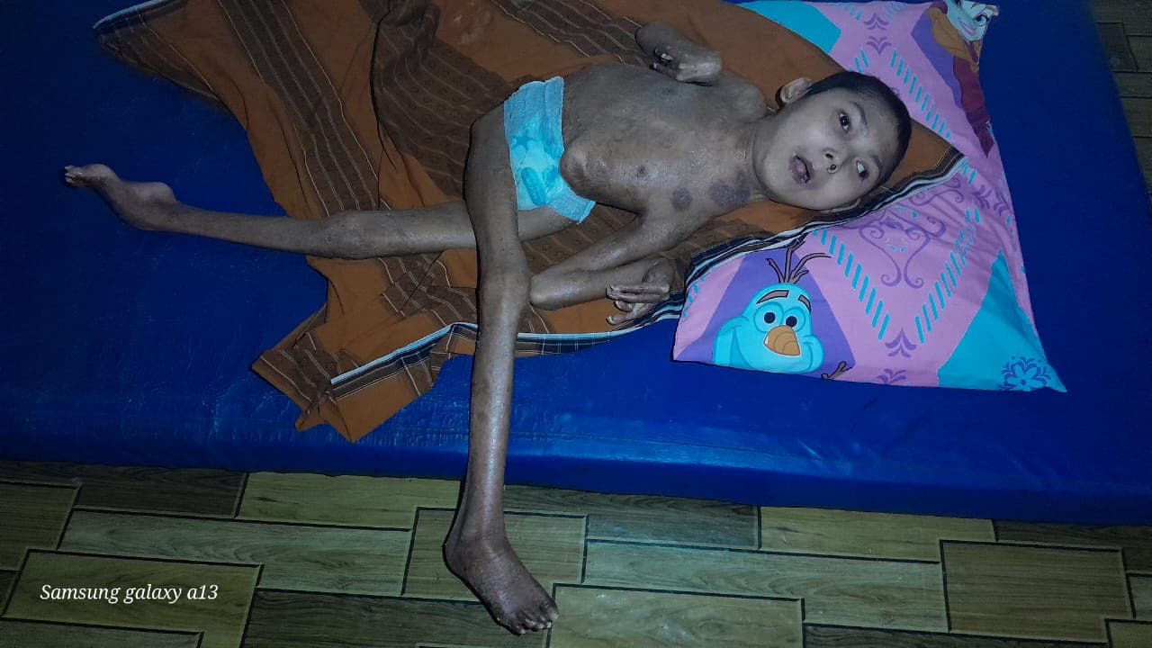 donasi-ini-adalah adik kandung saya, yang awalnya terlahi
