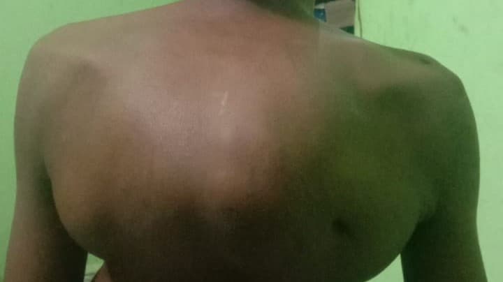 donasi-perkenalkan,-saya petrus ndakularak (32 tahun), sa