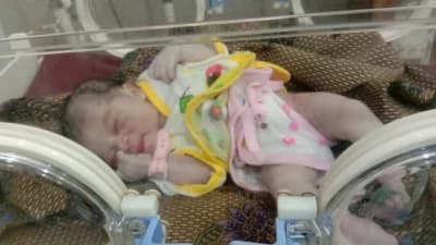 donasi-urgent-anak-kuli-lahir-tanpa-dubur-dan-penyakit-langka